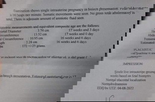 Ultrasound ,normal lang po ba lahat?