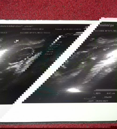 Tanda hamil bayi perempuan