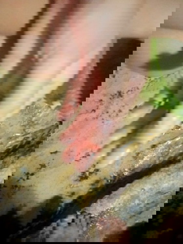 วันนี้เลือดออกเพิ่ม