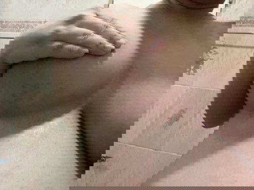 คันตรงรอยแดงใต้หน้าอกค่ะ