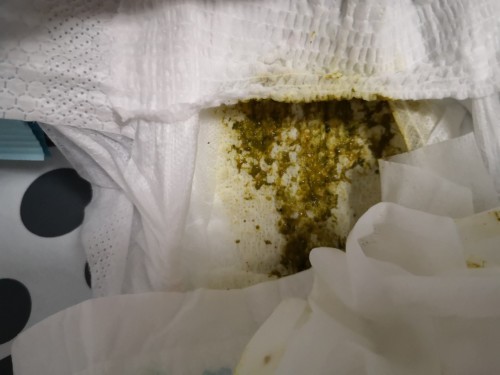 Is dark green poop normal for a 2 month old on full breastmilk?