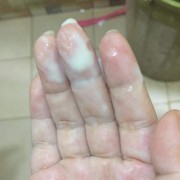 normal discharge or goes to labor