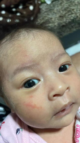 น้องเป็นเพราะอะไร