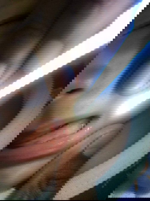 Bintik putih pada gusi bayi 4bulan