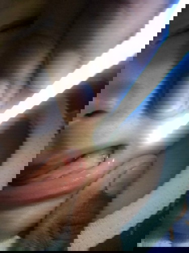 Bintik putih pada gusi bayi 4bulan