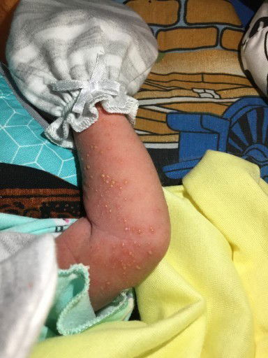 Bun,mau tanya pernah terjadi seperti ini gak pada banyinya, bayi saya baru 7 hari obatnya apa ya bun