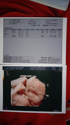 Menanti gelombang cinta dari dedebayi