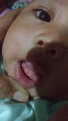Tumbuh gigi