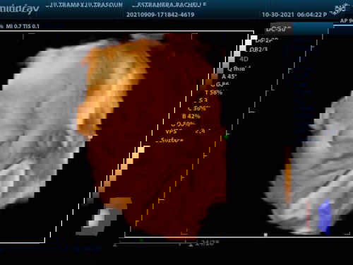 MY BABY BOY 🥺❤️