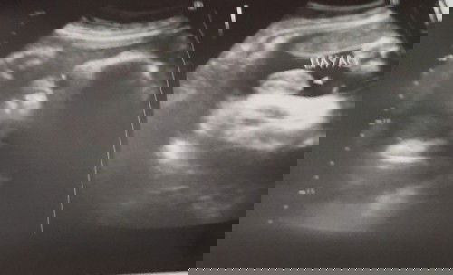 baby boy(team december)