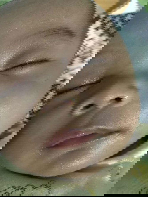 Apakah biang keringat?