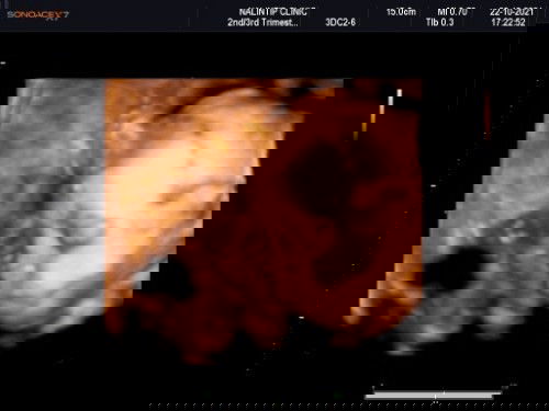 อยากเจอคนแปลกหน้าจัง
