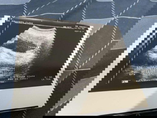 อยากรู้ว่า สรุปได้ลูกสาวหรือ ลูกชาย