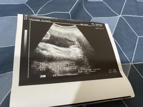 อยากรู้ว่า สรุปได้ลูกสาวหรือ ลูกชาย