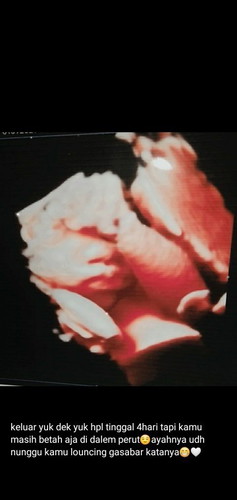 39w3d💛minta keikhlasan doanya bunda²semua🤲