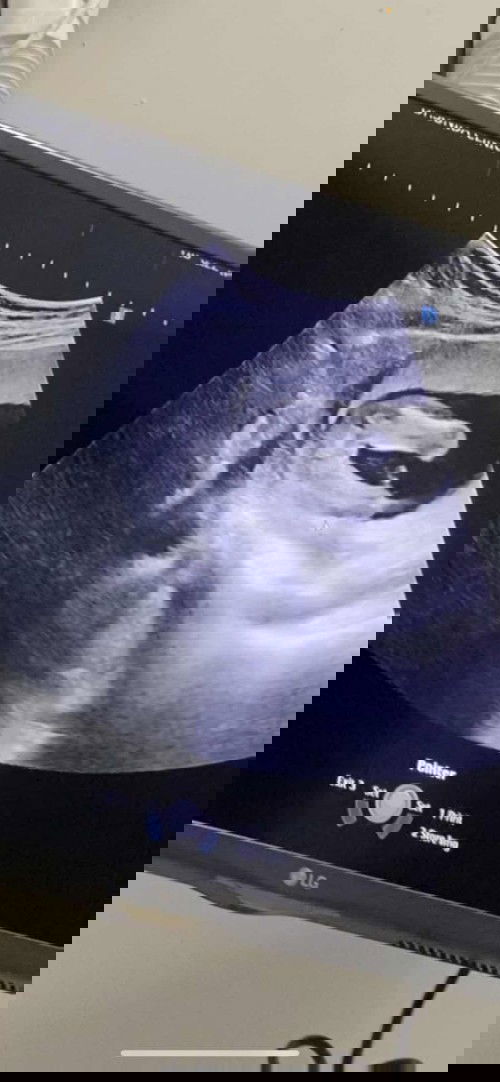 อยากสอบถามแม่ๆบ้านอื่นค่ะ