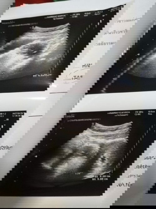 ขอคำแนะนำหน่อยค่ะ เผื่อใครมีประสบการณ์