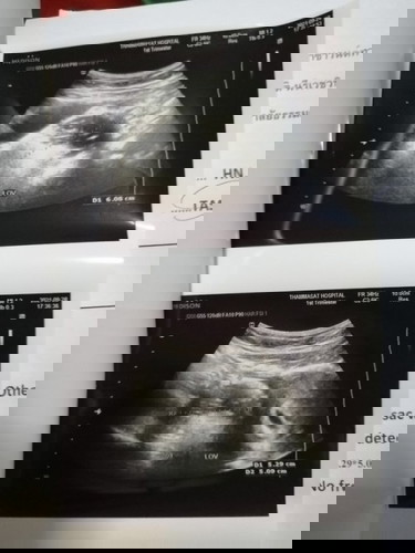 ขอคำแนะนำหน่อยค่ะ เผื่อใครมีประสบการณ์