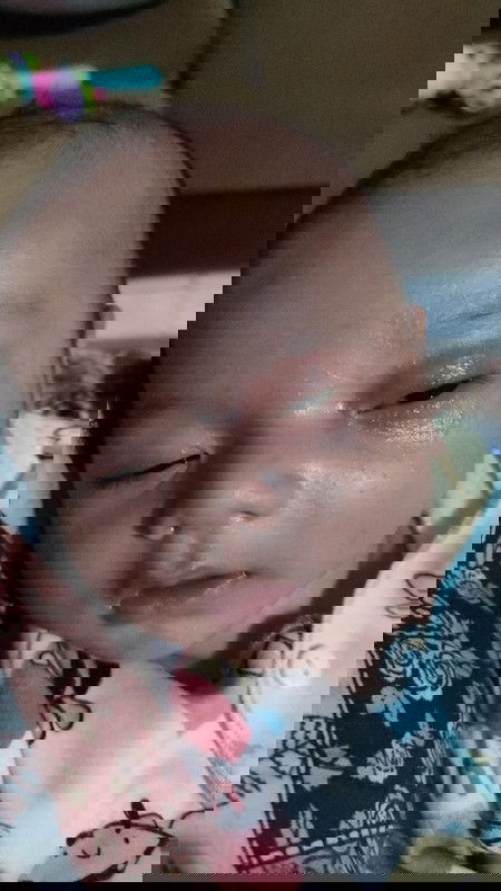 Sakit mata pada bayi 1 bulan