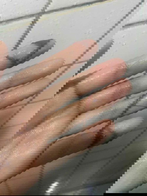 May flesh na discharge