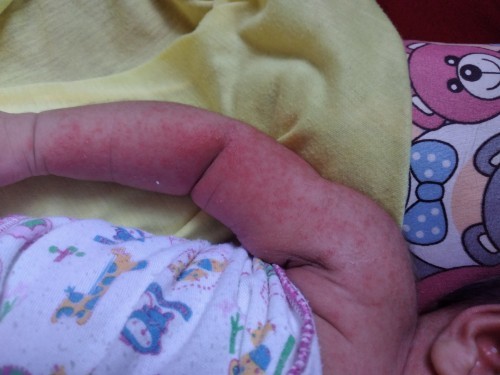 Muka dan badan timbul bintik merah