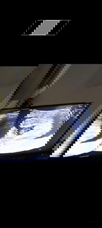 Gender. Is it a Boy or Girl?