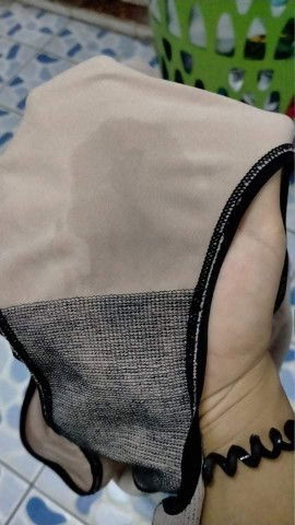 หมอกระตุ้นมามีน้ำแบบนี้คือไรคะ