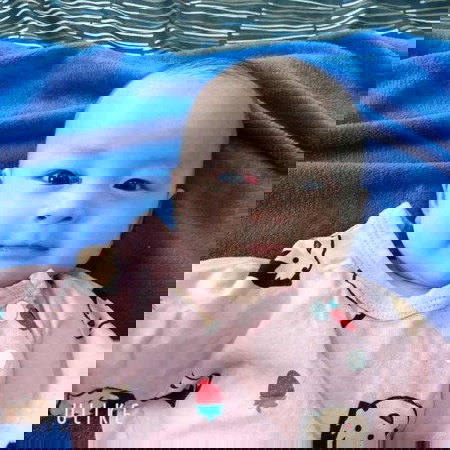 ปานแดงแบบนี้หมอบอกหายเองจริงไหม