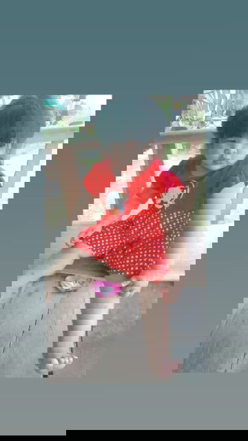 ยาทาผิวสำหรับเด็กแพ้ง่าย