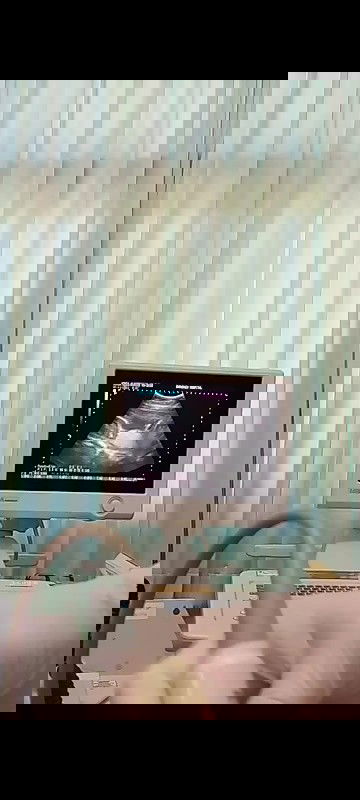 อยากรู้ว่าเพศหญิงหรือเพศชาย