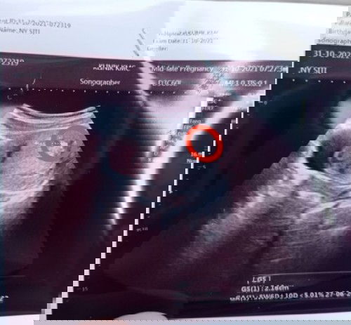 Kaya ada janin kecil