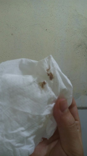 39w1d.dấu hiệu chuyển dạ