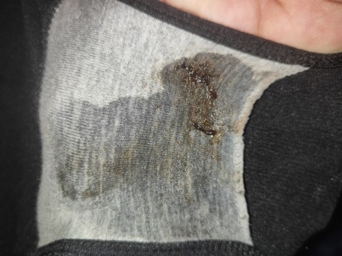 สอบถามหน่อยค่ะ มีแบบนี้ออกมาต้องปัยหาหมอเลยไหมคะไม่เจ้บท้อง ครรภ์38+1ค่ะ