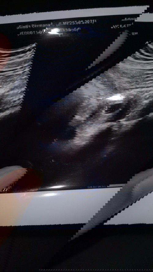 sintiatia468@gmail.com