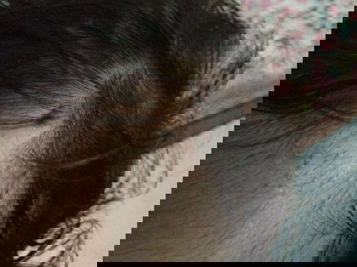 Kepala bayi ada berair dan jadi kerak