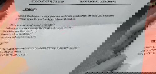 Okay lng po ba ultrasound ko? Thank you in advance po