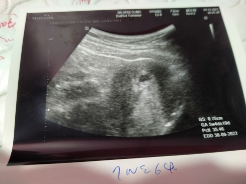 ตั้งครรภ์ขอคำเเระนำหน่อยค่ะ