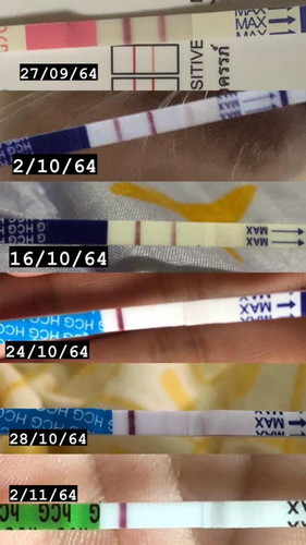 ตรวจการตั้งครรภ์
