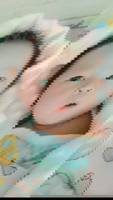 ขอคำปรึกษาลูดตัวเหลือง