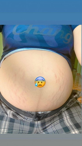 ยังจะแตกเยอะกว่านี้ไหมคะ