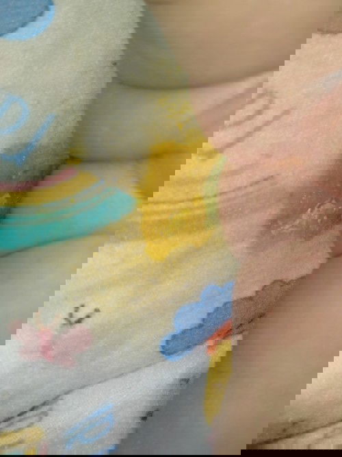 อึของลูกเเบบนี้ปกติไหม