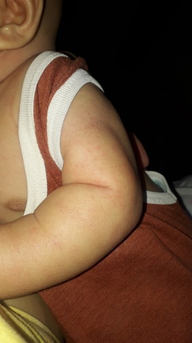 Sino po dito same case sa baby ko.. nakaka estress na po😢 nagpa pedia na kami.. pero wala pa din...