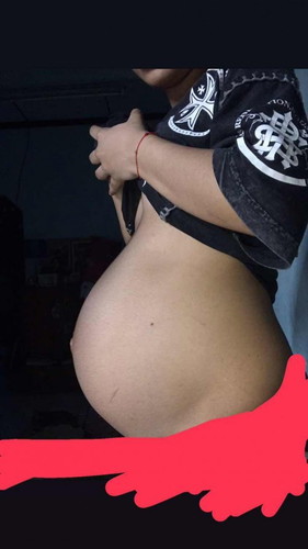 แม่ๆคะแบบนี้เรียกว่าท้องลดรึยังคะ 37สัปดาวันนี้ค่ะ