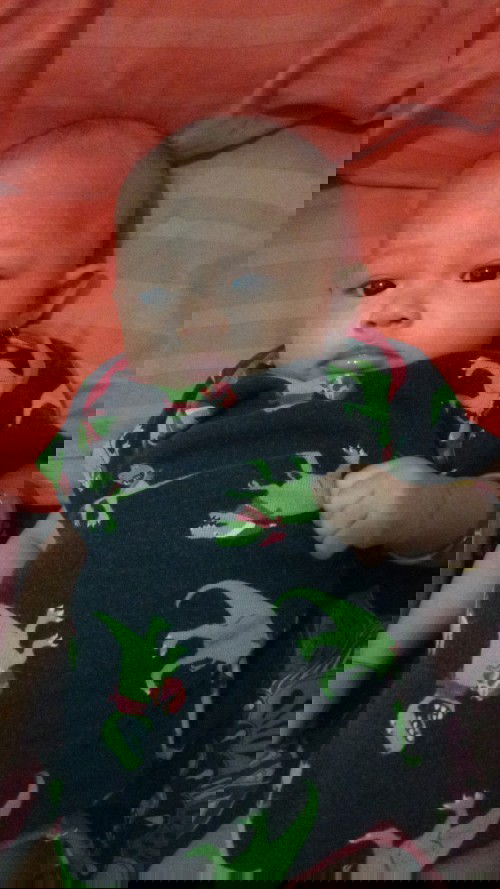 Jidat anak seperti panu