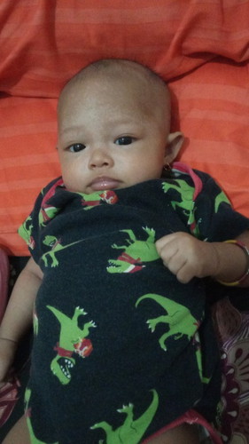 Jidat anak seperti panu