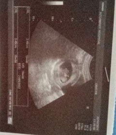 แม่มือใหม่