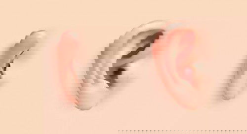 ภาวะใบหูเล็กไม่สมบูรณ์