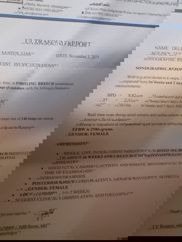 May Chance papo ba Umikot si baby? 😔