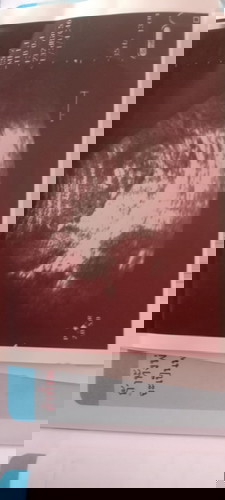 ภาพอัลตร้าซาวโรงบาลแถวบ้านดุออกไหมค่ะแม่ๆบ้านนี้ดุไม่ออกเลย