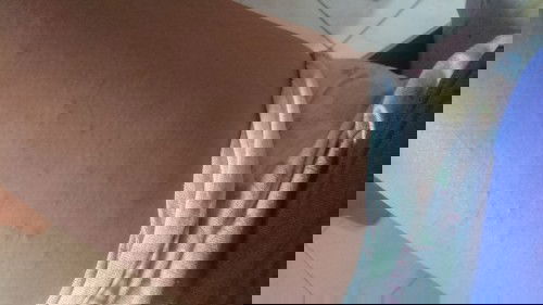 Rashes on 3rd Trimester